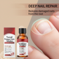 🔥Christmas Limited-Time Offer:64% OFF!!!🔥Nail Repair Essence for Damaged Nails